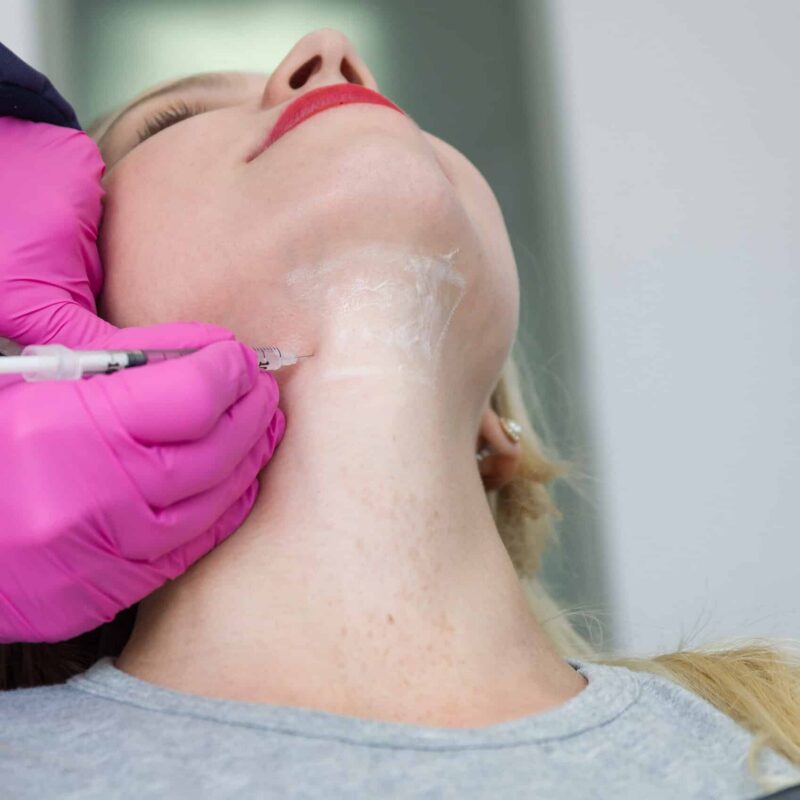 Kybella by DBA: Epiphany Medspa & Wellness in N Euclid St, Fullerton, CA United States
