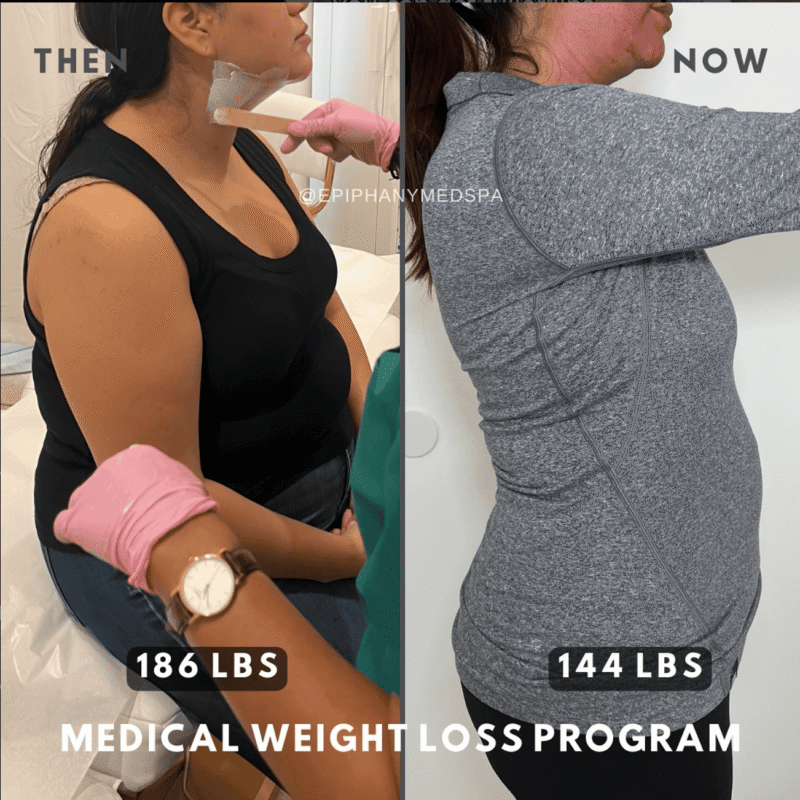 medical weight loss program