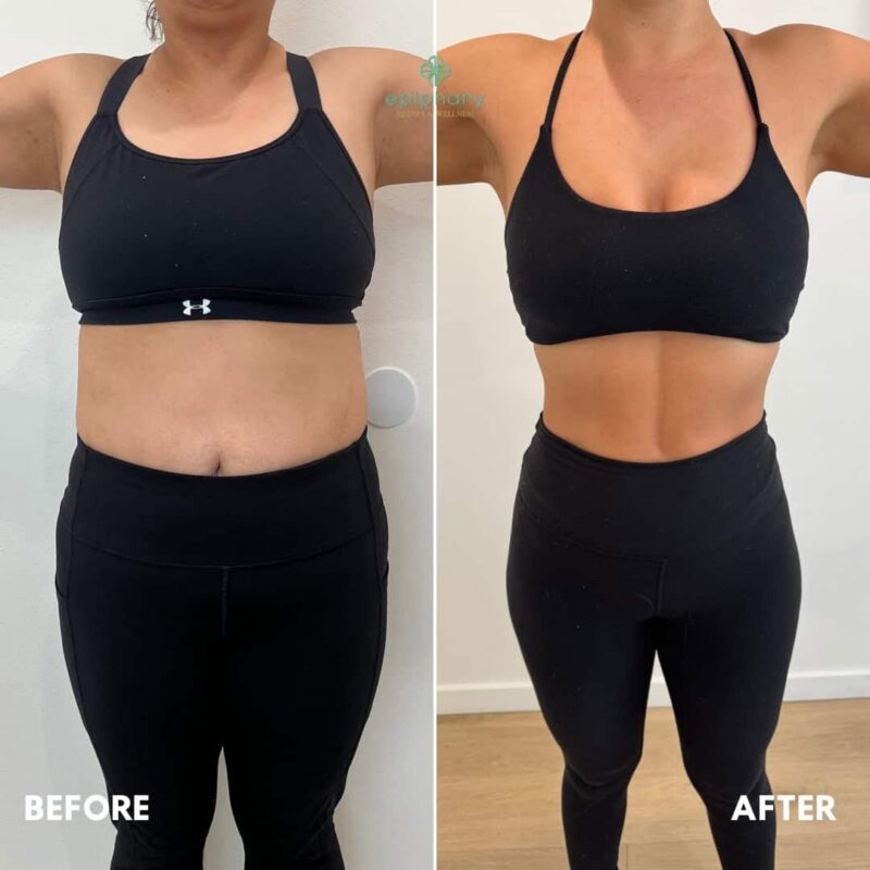 weight loss Ozempic